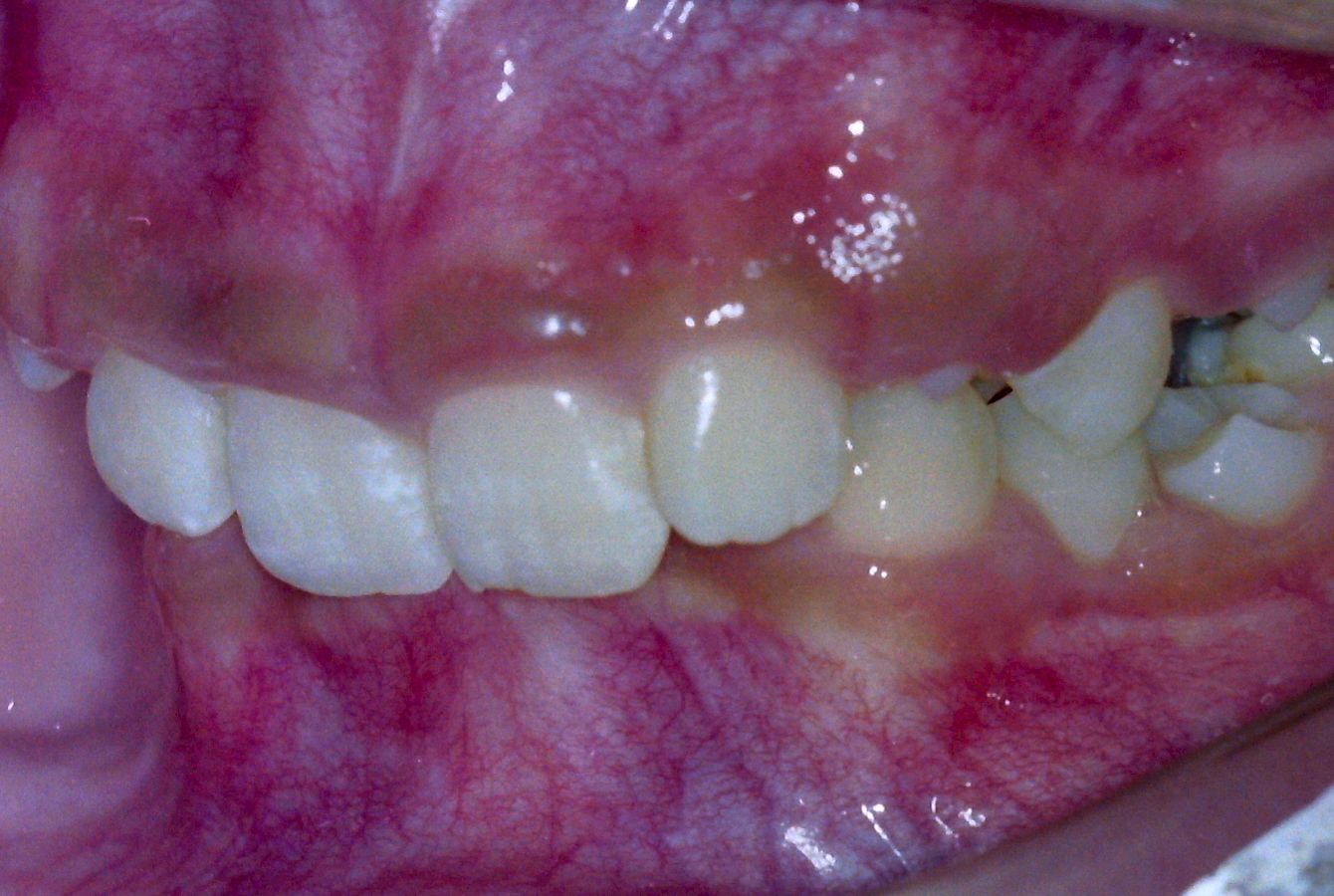 Before